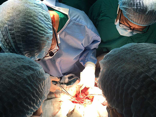 Các BS Bệnh viện Chợ Rẫy đang thực hiện ca ghép tim lần đầu tiên